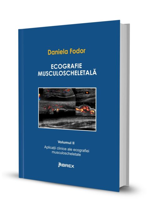 Ecografie musculoscheletală – Daniela Fodor – Vol. II Ecografie musculoscheletală – Daniela Fodor – Vol. II
